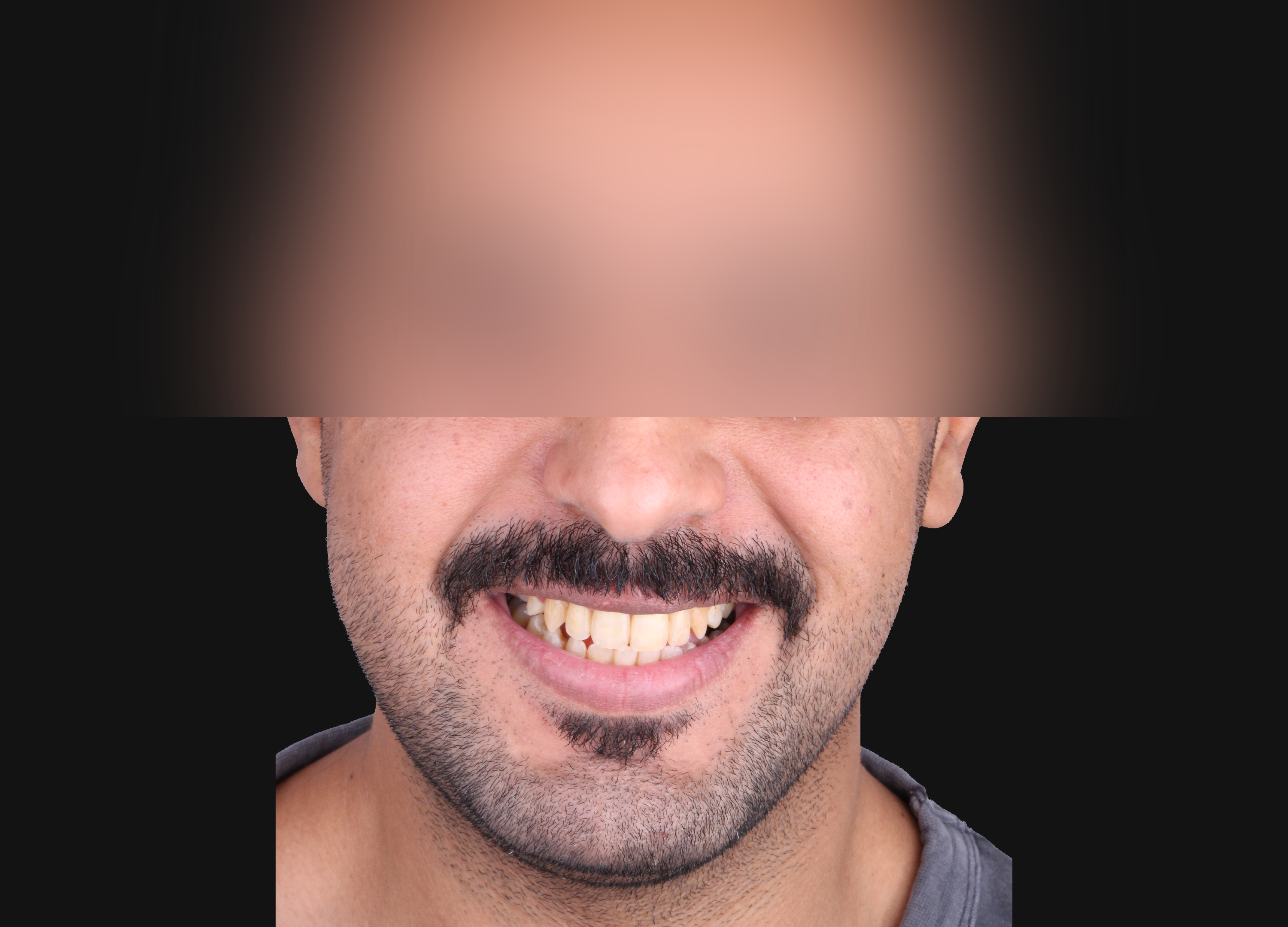 بعد