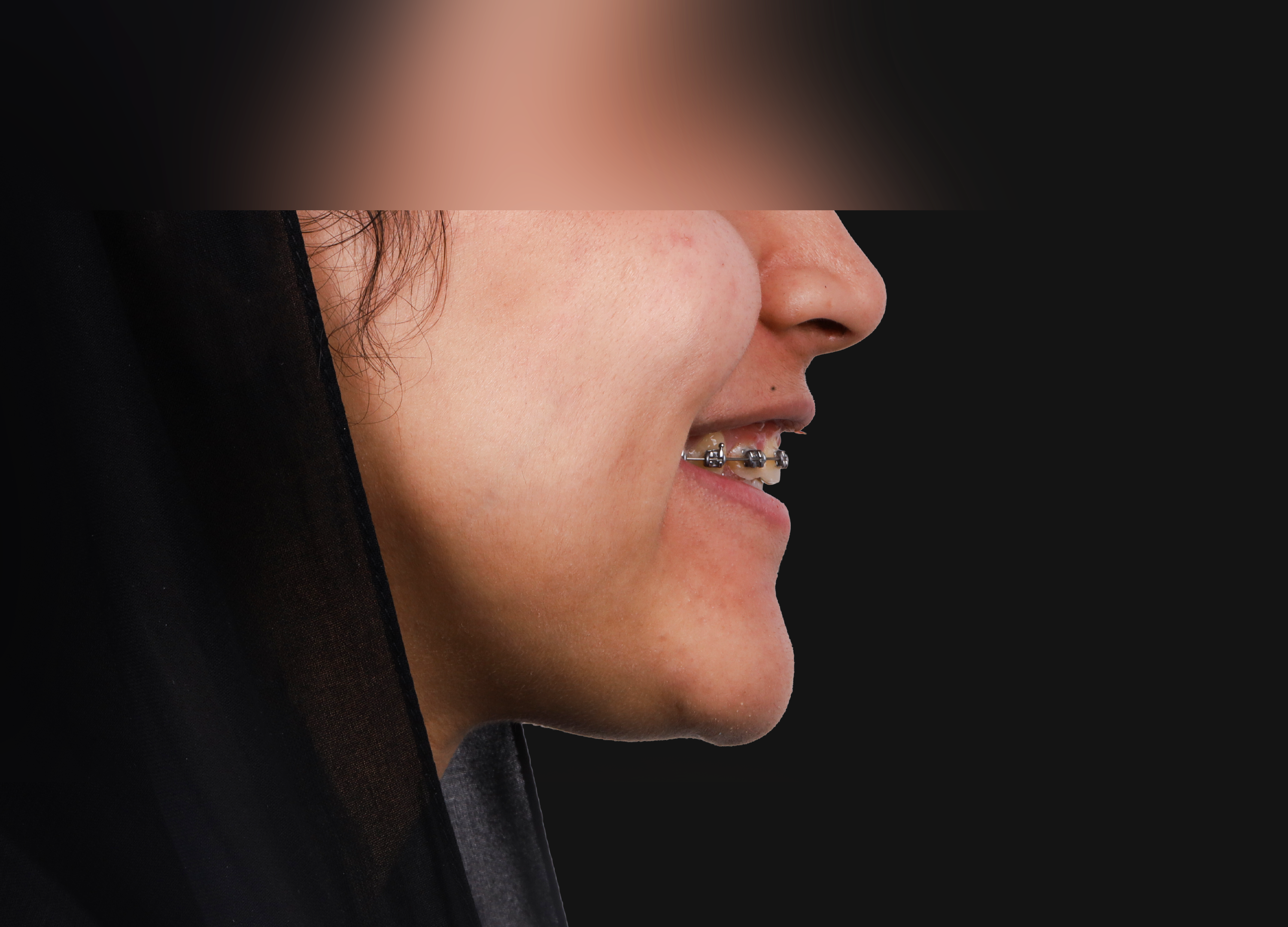 بعد