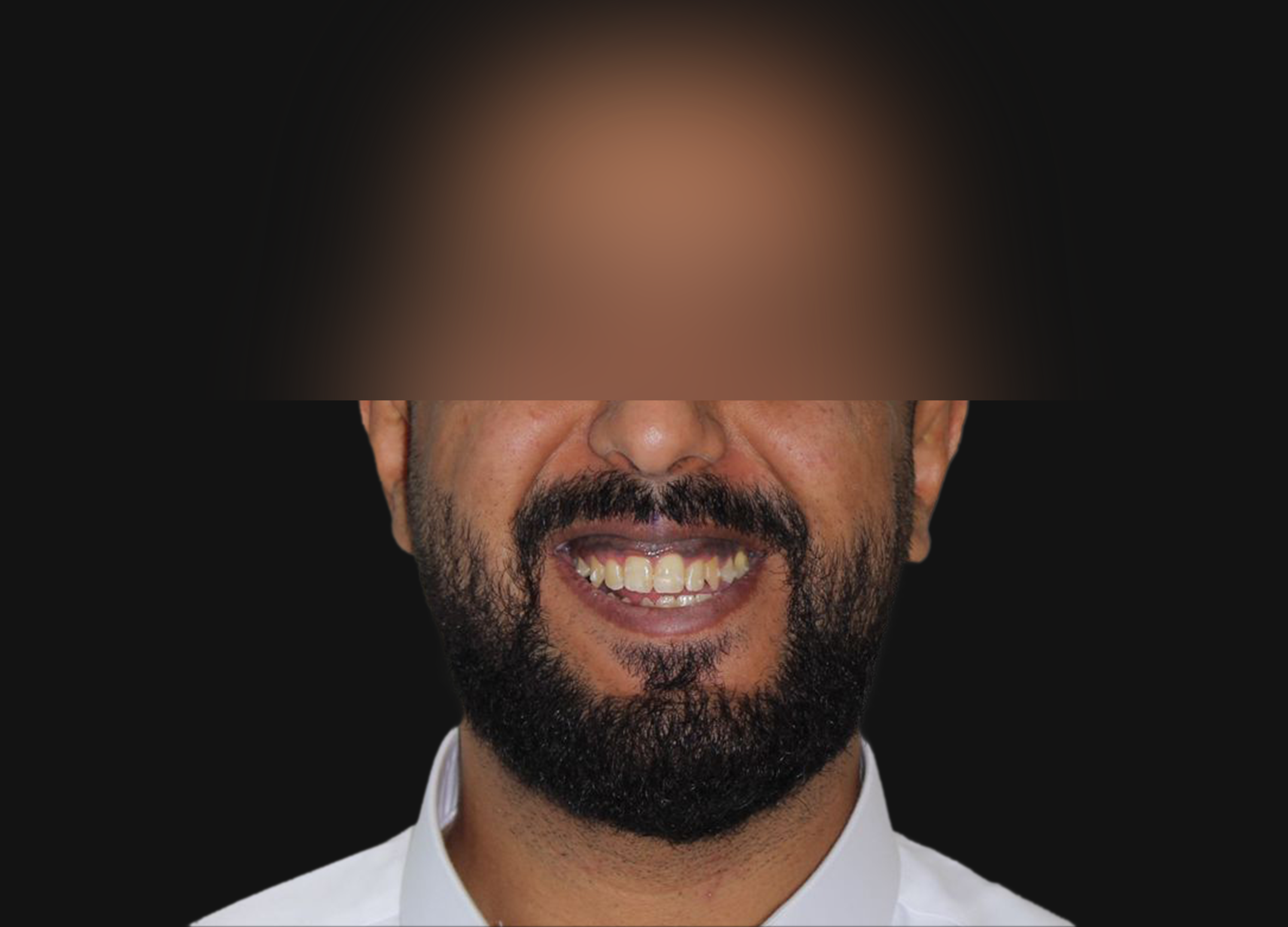 قبل